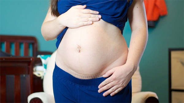 Những điều cần biết dành cho mẹ muốn sinh thường sau khi đã từng sinh mổ