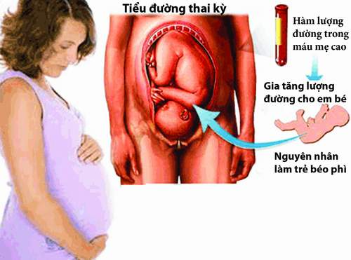 biến chứng tiểu đường thai kỳ