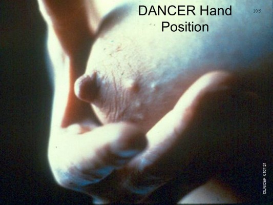 dancer-hand-position-1